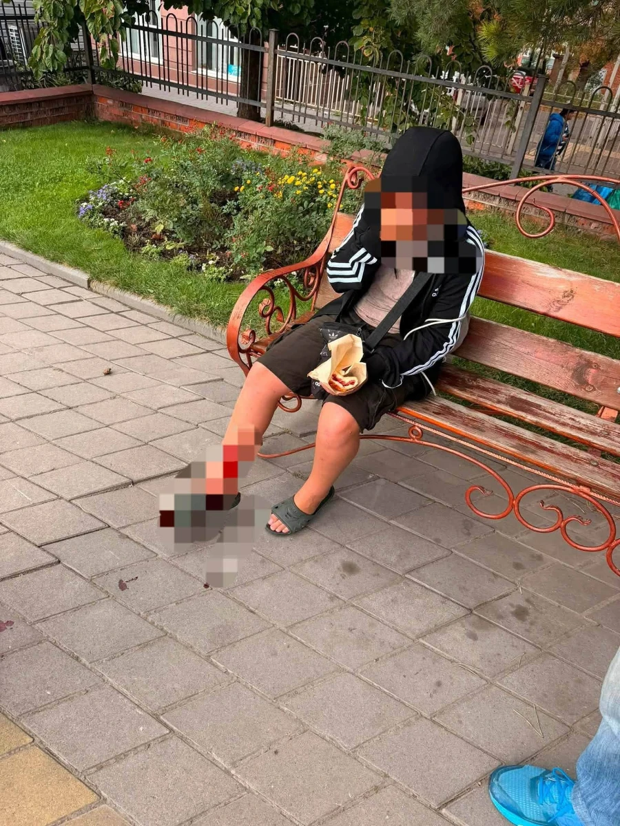 У Жмеринці собаки кусають перехожих: за пів року до лікарні звернулися 89 людей